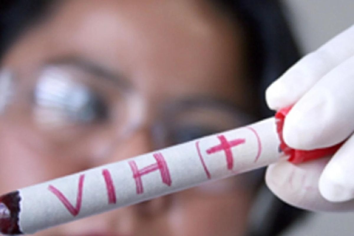 Científicos logran eliminar VIH de células infectadas 1 eliminan VIH de células infectadas
