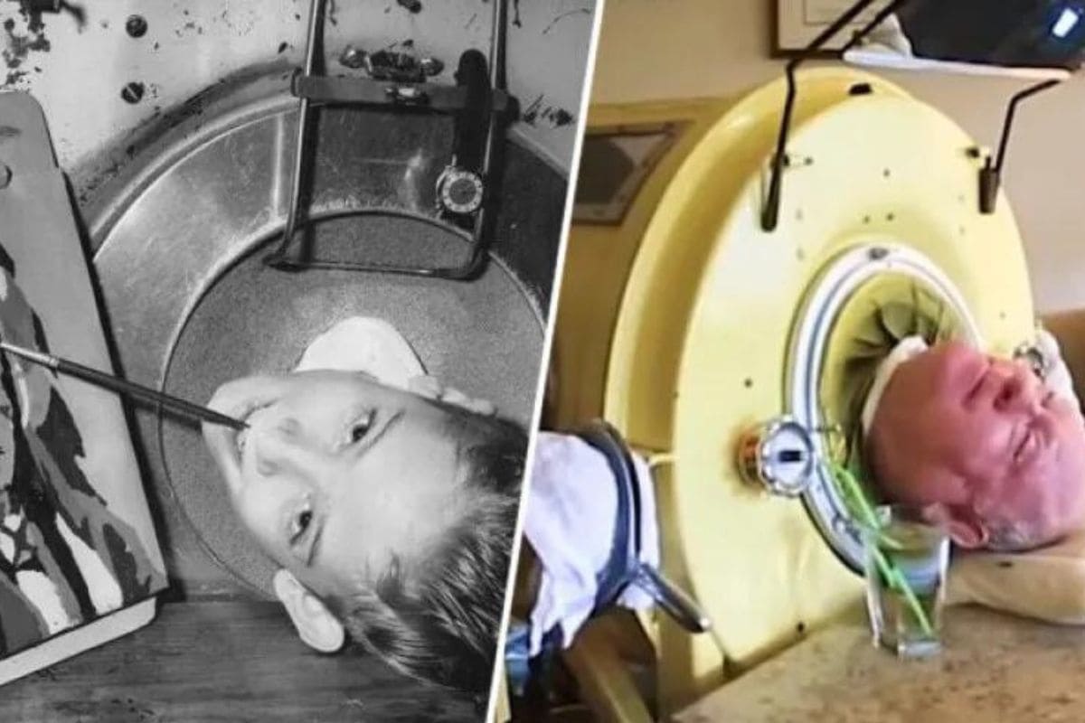 Muere Paul Alexander, hombre que vivió más de 70 años con “pulmón de acero” por polio 1 Paul Alexander muere