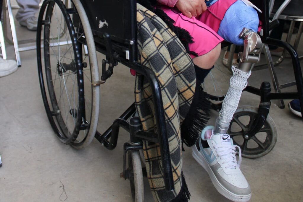 requisitos para pedir una prótesis al DIF de Puebla