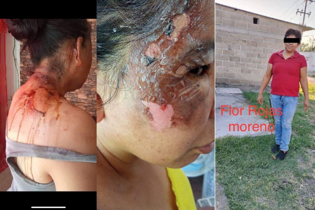 Justicia para Marta: Le avientan agua hirviendo y la despiden en restaurante de Izucar 3 Justicia para Marta: Le avientan agua hirviendo y la despiden tras agresión en el restaurante Casa Grande