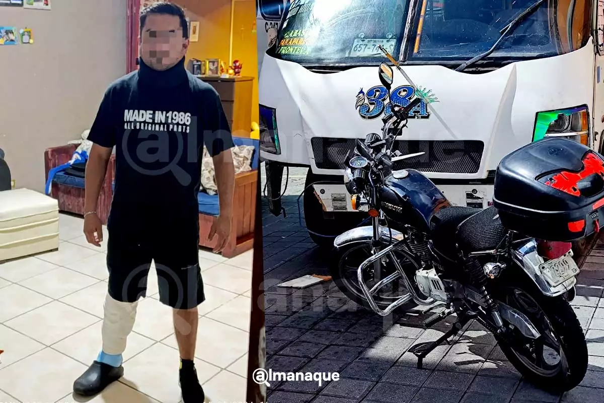 Este ha sido el calvario de motociclista atropellado por ruta 38A en Puebla 1 motociclista atropellado por ruta 38a exige justica