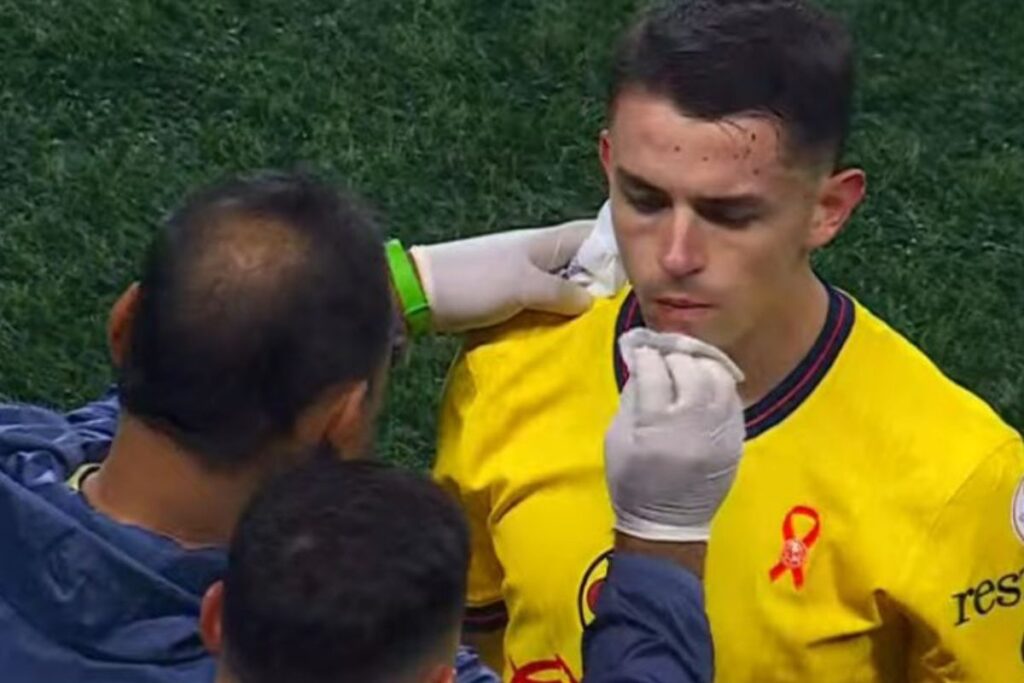 Agresión a Álvaro Fidalgo en el Xolos vs América