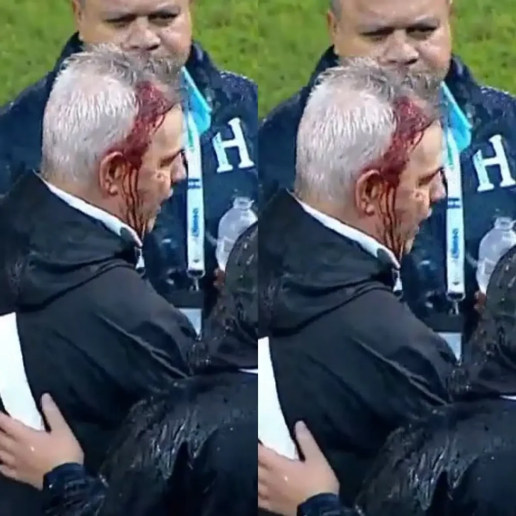 ¿Dónde ver el México vs Honduras y a qué hora? 2 ¿Dónde ver el México vs Honduras y a qué hora?