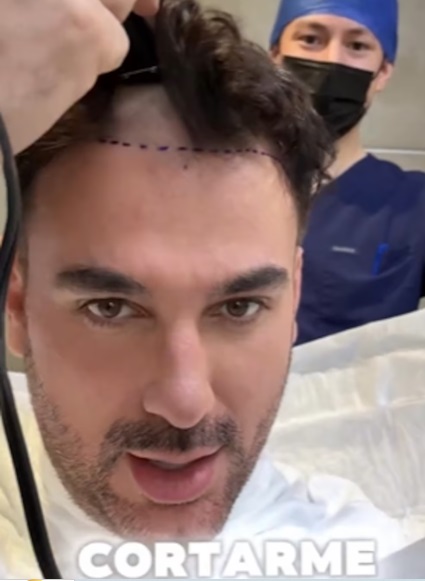 Ex actor de Televisa aparece con el rostro desfigurado