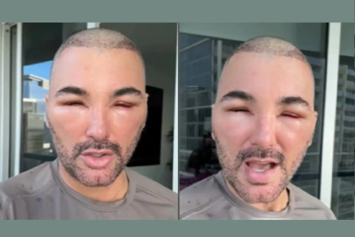 Ex actor de Televisa aparece con el rostro desfigurado ¿Qué le pasó? 1 Ex actor de Televisa aparece con el rostro desfigurado ¿Qué le pasó?