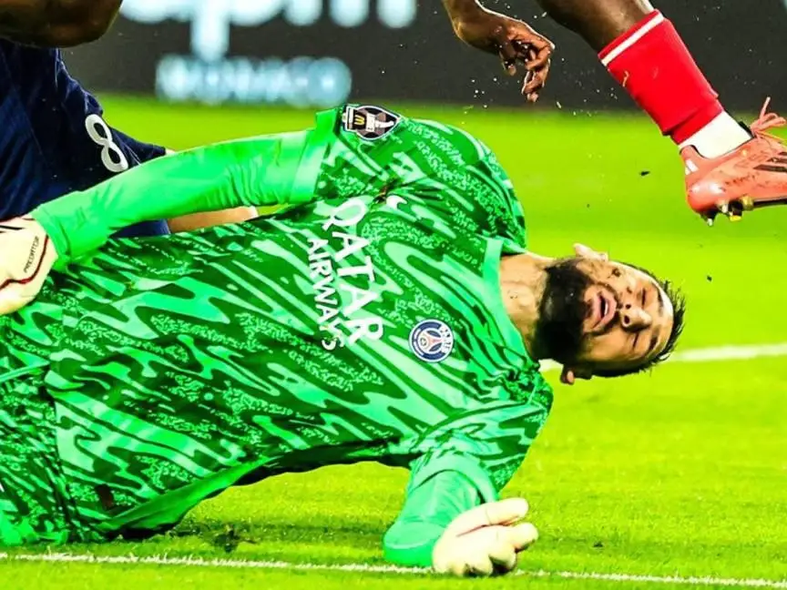 Así quedó la cara de Gianluigi Donnarumma