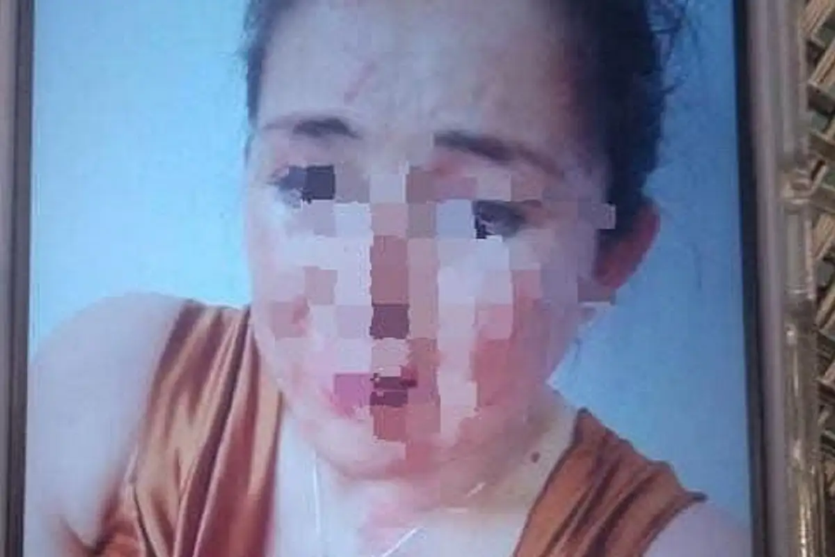 Rescatan a esposa de regidor de Tlaxcala tras brutal golpiza 1 Rescatan a esposa de regidor de Tlaxcala tras brutal golpiza