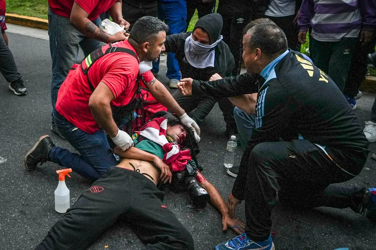 En protesta, le disparan a Pablo Grillo, fotorreportero argentino