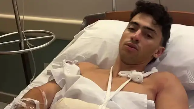 Gero Arias, el influencer que se cayó en un cerro y perdió dos dedos