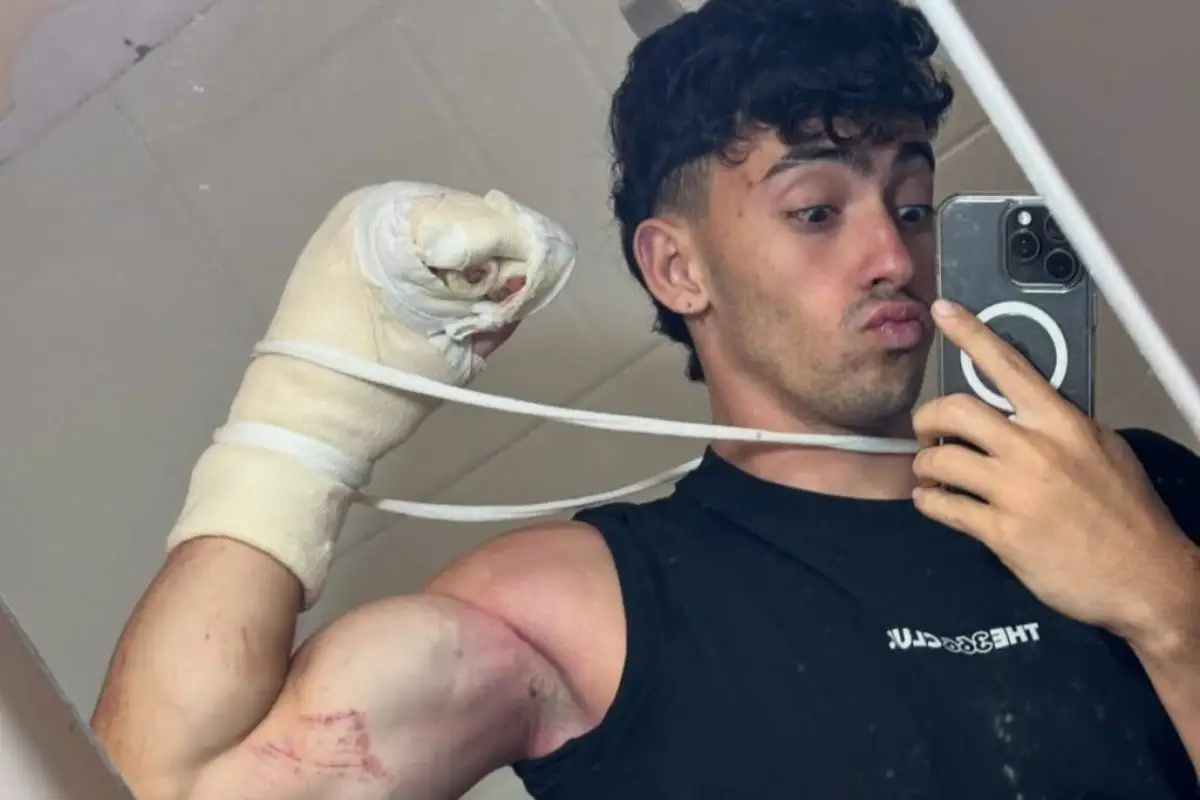 Gero Arias, el influencer que se cayó en un cerro y perdió dos dedos 1 Gero Arias, el influencer que se cayó en un cerro y perdió dos dedos