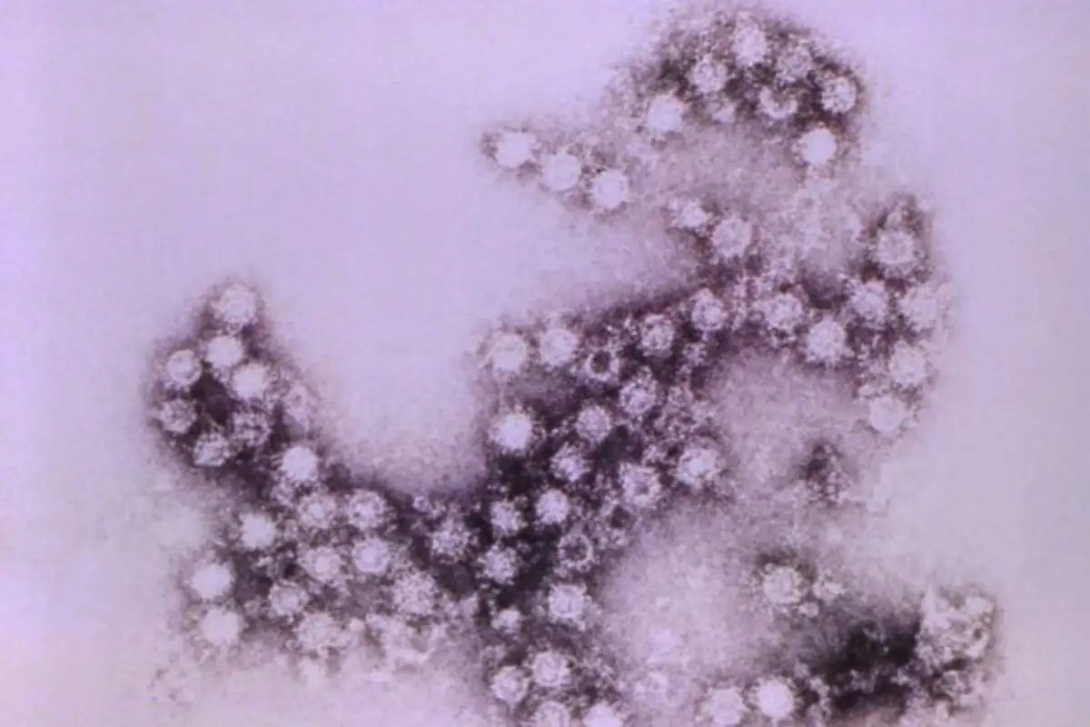 Virus Coxsackie en Puebla: Se confirma brote en primaria de Bosques de San Sebastián 1 Virus Coxsackie en Puebla: Se confirma brote en primaria de Bosques de San Sebastián