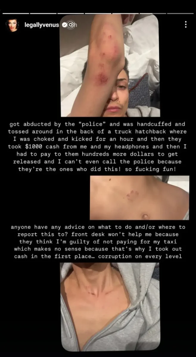 Ganadora de “Canada’s Drag Race” denuncia golpiza por parte de policías en México