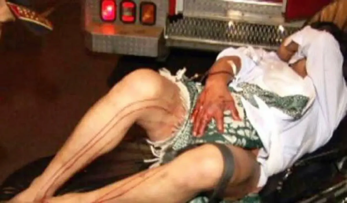 IMÁGENES FUERTES: Mujer le corta el pene a su esposo tras enterarse que abusó de su sobrina 2 Mujer le corta el pene a su esposo tras enterarse que abusó de su sobrina