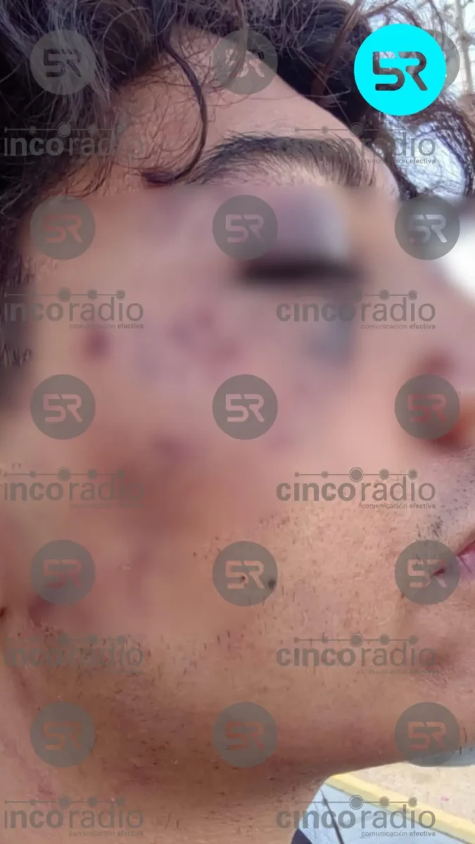 Muñemiches de CU es clausurado tras golpiza de cadeneros a joven