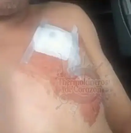 Trailero baleado en la México-Puebla es multado tras pedir ayuda