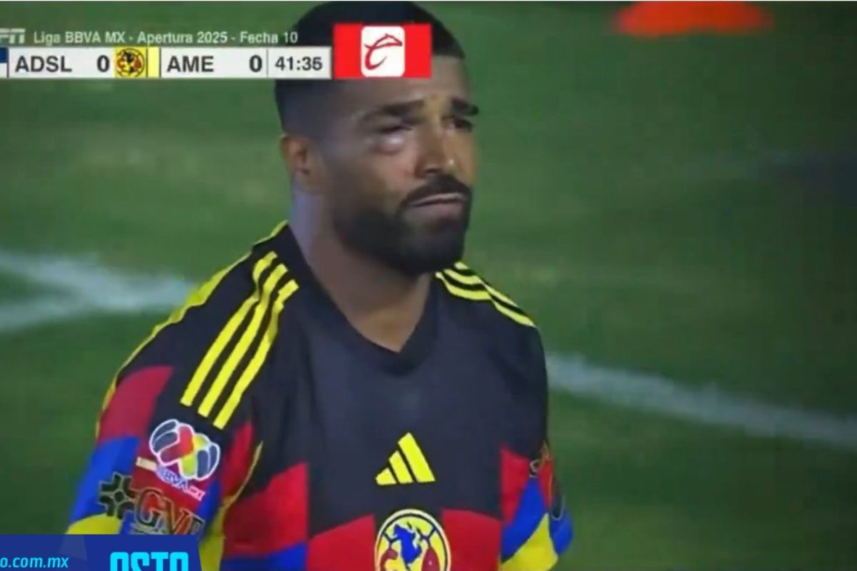 Como boxeador- Así le quedó la cara al Búfalo Aguirre en el San Luis vs América  