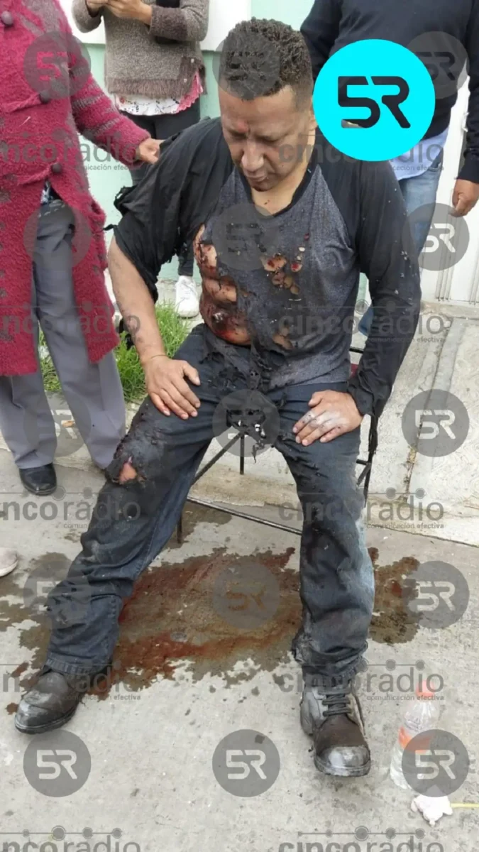 Explosión de un cohete en Nativitas deja dos heridos durante festejos patrios