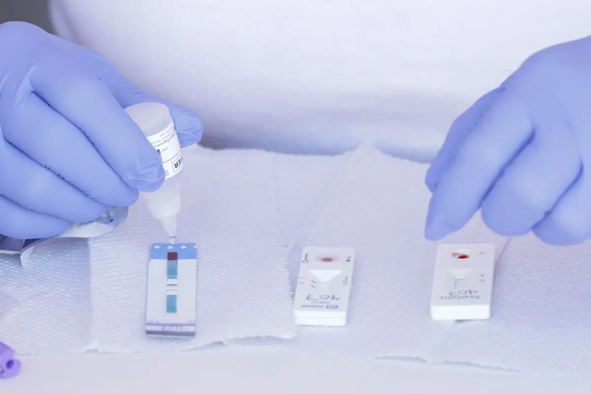 Atienden 5 mil 959 casos de VIH en Puebla 2025