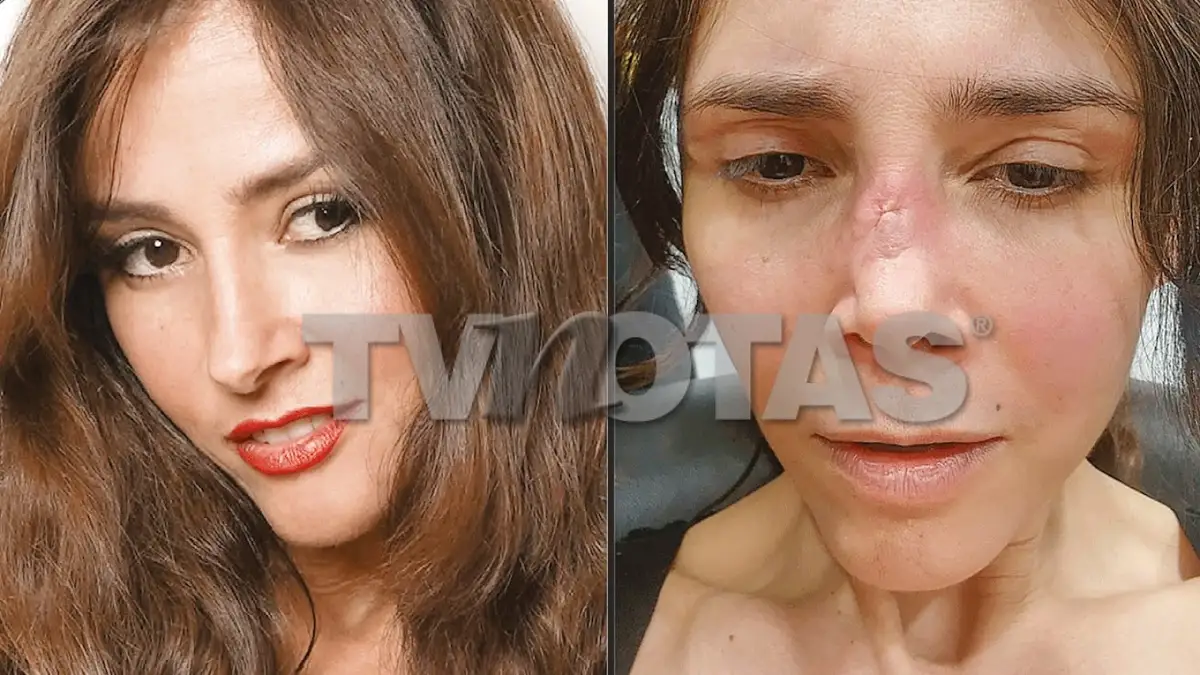 Dorismar reaparece con el rostro desfigurado