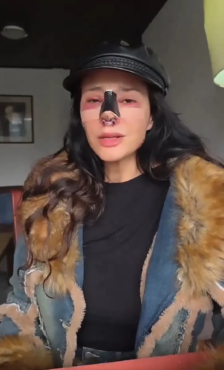 Dorismar reaparece con el rostro desfigurado