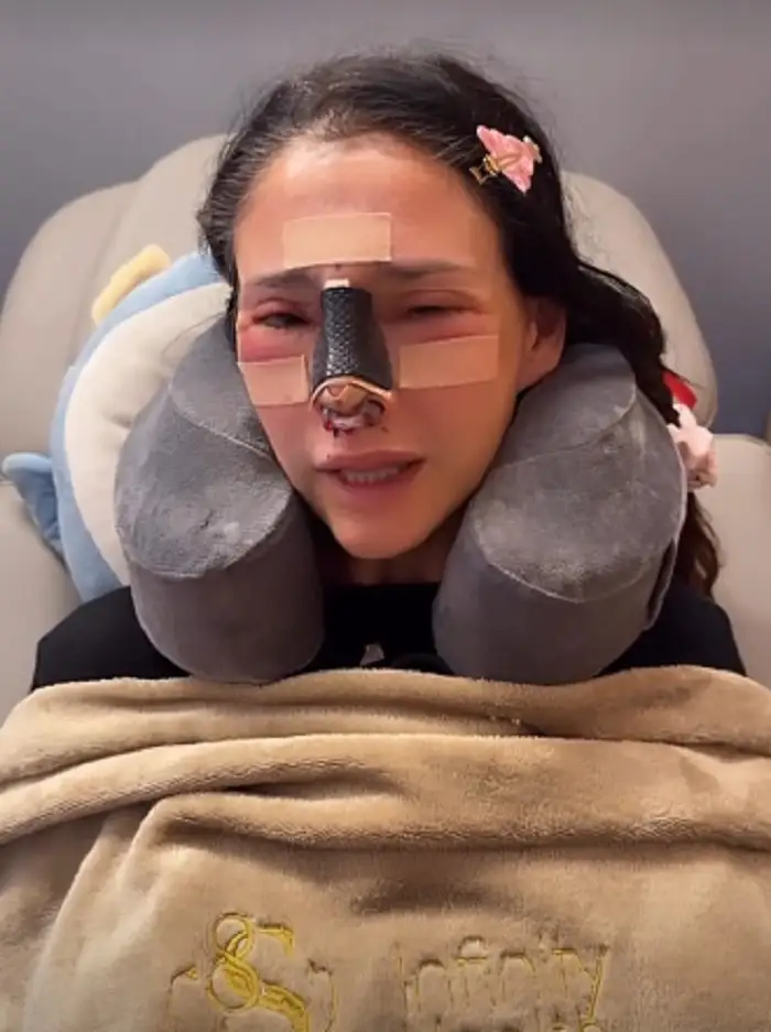 Dorismar reaparece con el rostro desfigurado