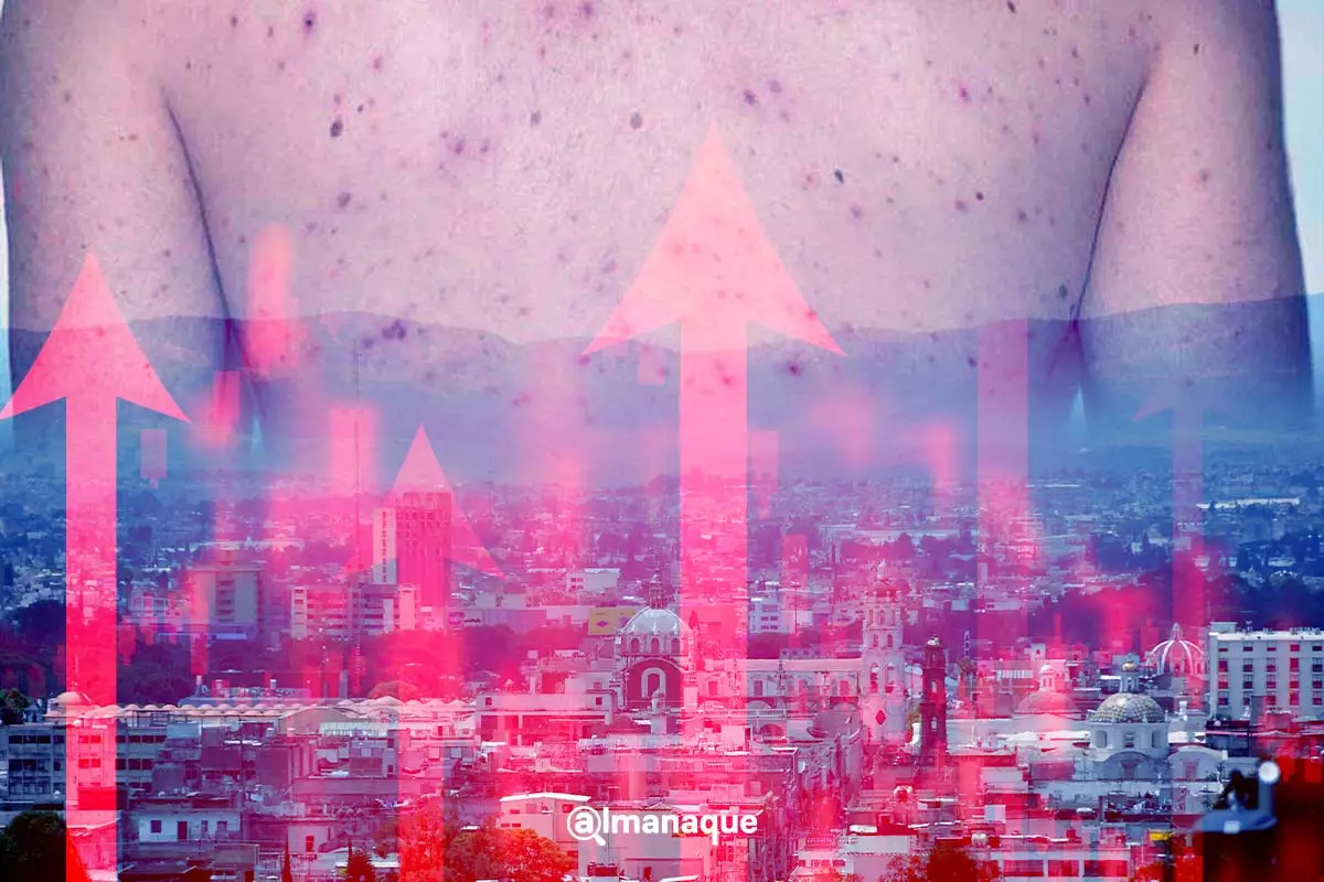 Casos de sarampión en Puebla crecen 130% en lo que va de febrero  